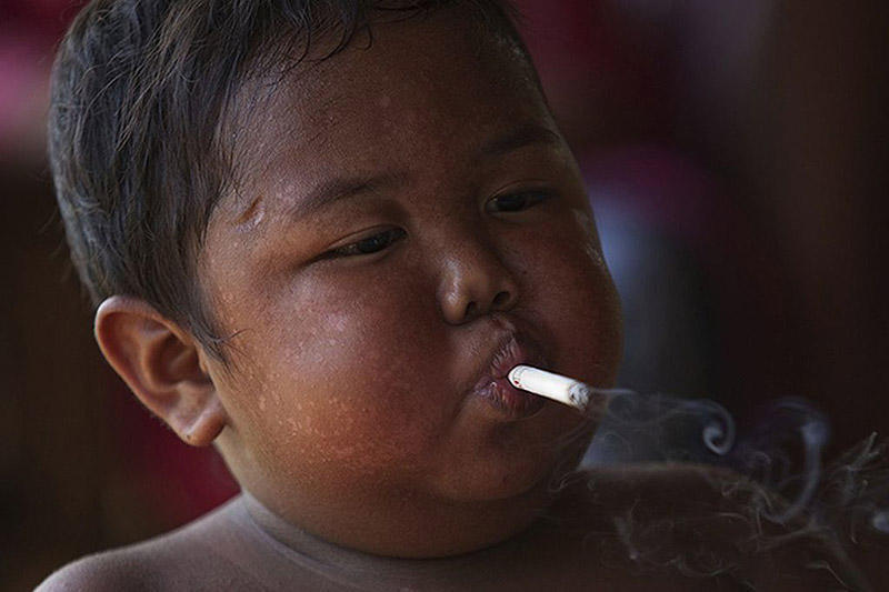 Дворічний малюк викурював  близько 40 сигарет щодня! До чого довів такий спосіб життя.(ФОТО) (ВІДЕО)
